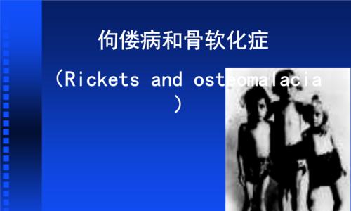 预防与治疗幼犬佝偻病的完全指南（以宠物为主，从源头防治，让幼犬远离佝偻病的痛苦）