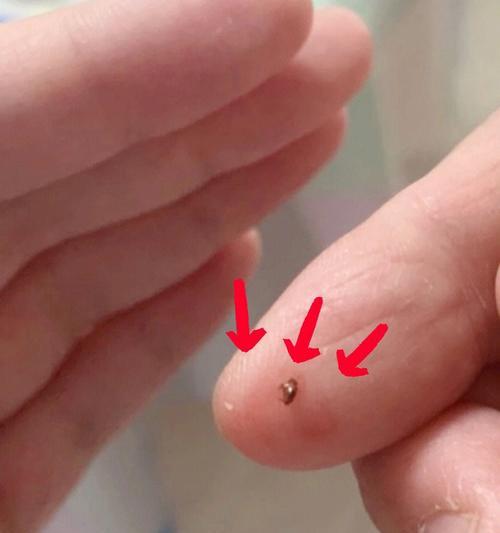 如何清除金毛身上的跳蚤？如何预防跳蚤感染？（如何清除金毛身上的跳蚤？如何预防跳蚤感染？）