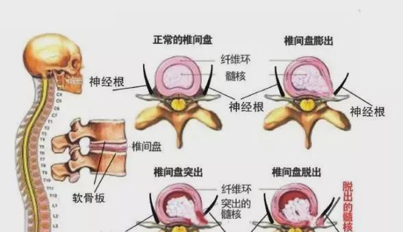 如何预防京巴犬腰椎病——从宠物的健康出发