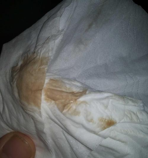 小狗下体流灰褐色液体，可能患上这些疾病！（宠物主人必读，了解小狗健康状况的重要性）