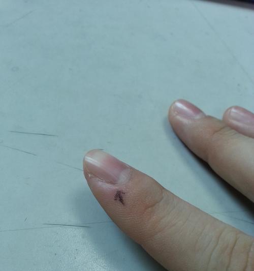 宠物狗咬人事件的应对措施（以自己家两个月小狗咬了怎么办为例，详细解析主人应对之道）