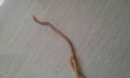 狗狗拉虫子后出现便血该怎么办（宠物虫感染引发的便血症状及治疗方法）