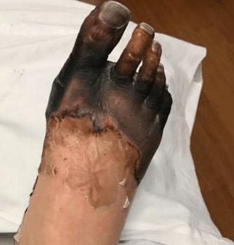 如何为小狗断腿时使用正确的药物治疗（以宠物为主）