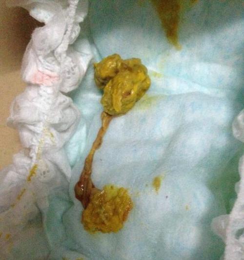 小猫大便带血丝，你需要知道的原因和处理方法（宠物健康问题解决方案）