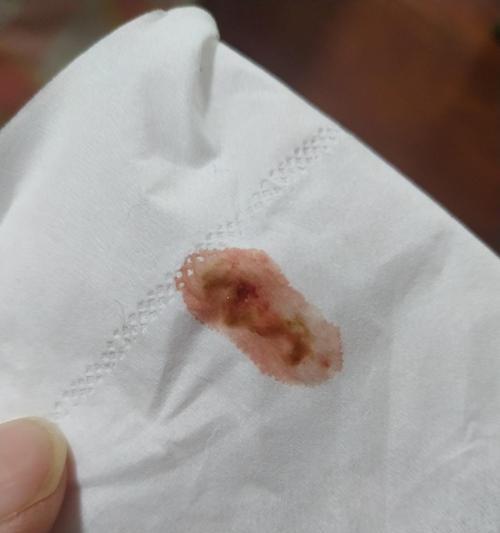 宠物小猫的便便黏在屁股上的解决方法（如何帮助宠物小猫摆脱便便黏在屁股上的尴尬情况）