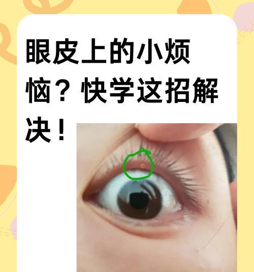 吉娃娃眼皮小疙瘩怎么办？有什么小妙招可以解决？