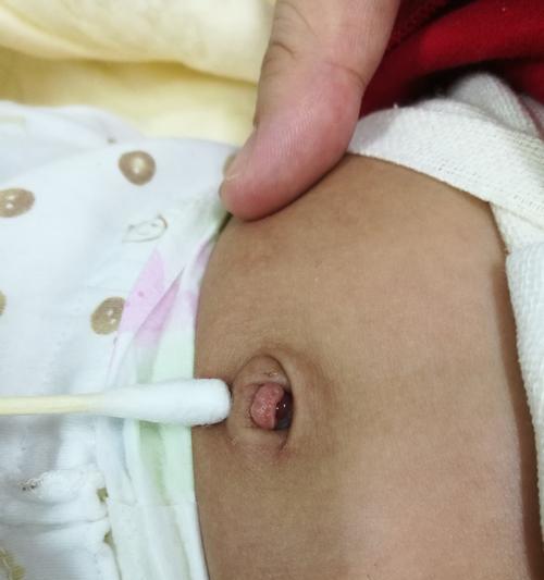 吉娃娃肚脐眼大疙瘩？可能原因和处理方法是什么？