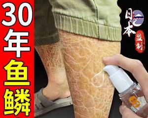 鱼鳞变黑应如何治疗及使用什么药物？