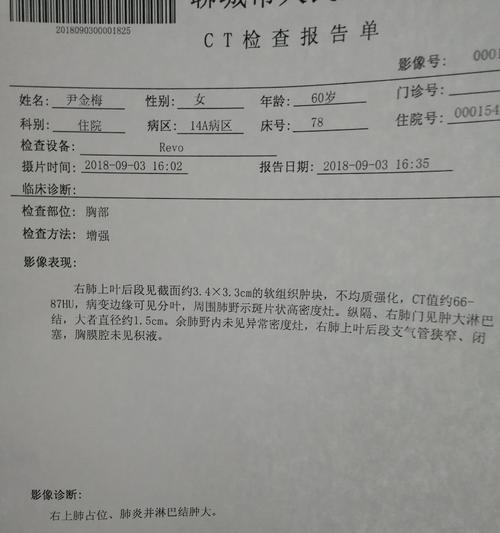 吉娃娃持续有痰？有哪些治疗方案？