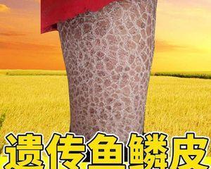 鱼鳞发黑应如何治疗？哪种药膏效果最佳？
