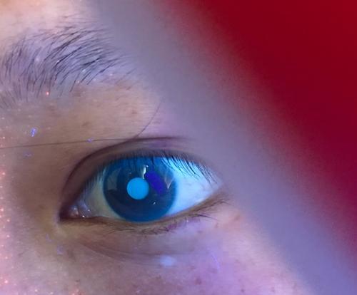 金刚鹦鹉鱼眼睛白点原因及治疗方案是什么？