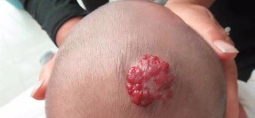布偶猫病毒性心肌炎的严重性如何判断？出现症状后应采取哪些措施？