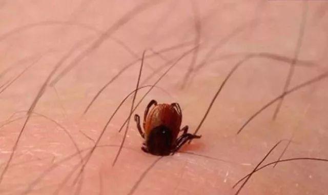 狗身上的牛蜱怎么办？有效去除和预防方法是什么？