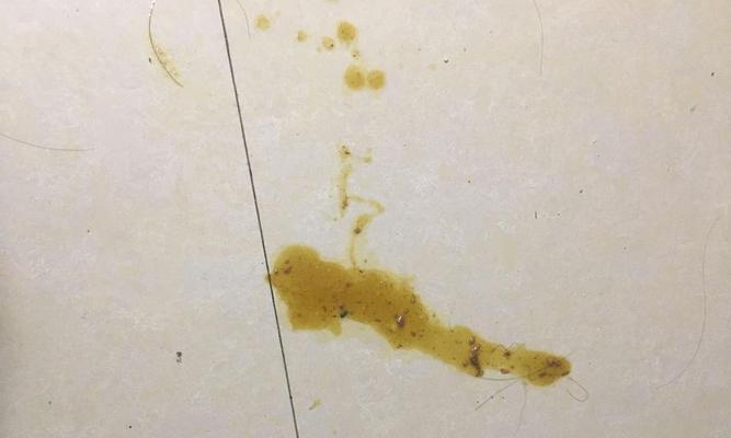 猫咪吐黄水怎么回事？如何判断原因及应对措施？