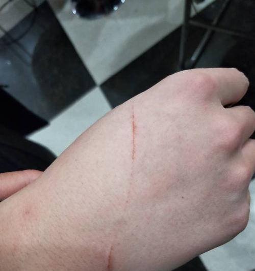 猫咪舔伤口是正常行为吗？如何正确处理？
