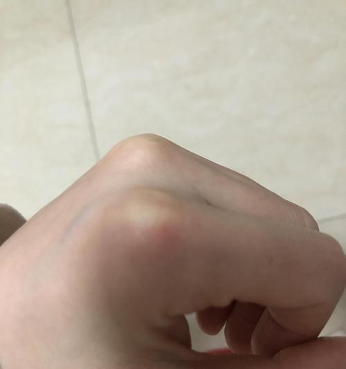 没打疫苗的小猫咬伤了怎么办？如何处理伤口和预防疾病？
