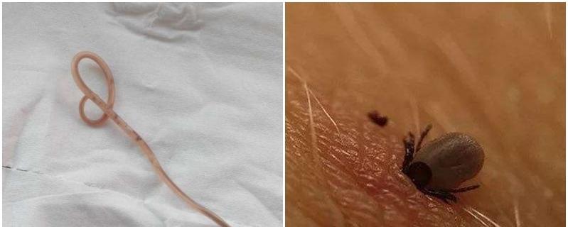 小猫身上挤出寄生虫怎么办？如何预防和治疗？
