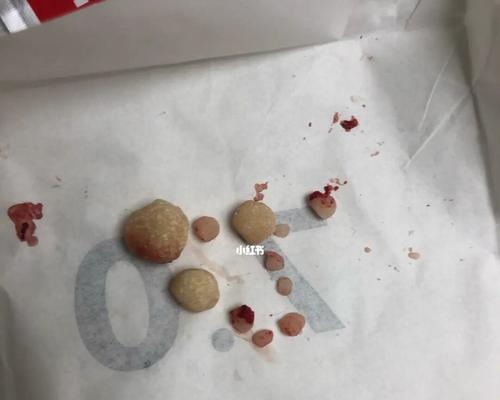 狗狗膀胱结石需要打什么针？治疗过程是怎样的？