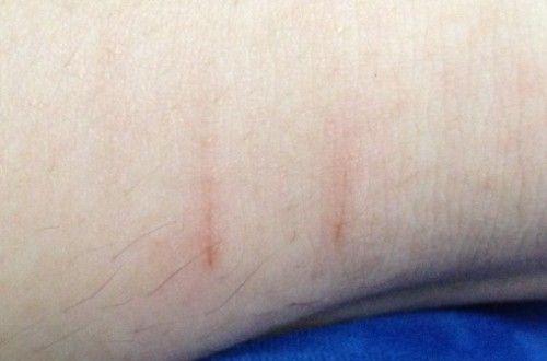 狗狗被咬伤出血怎么办？紧急处理和后续护理方法是什么？