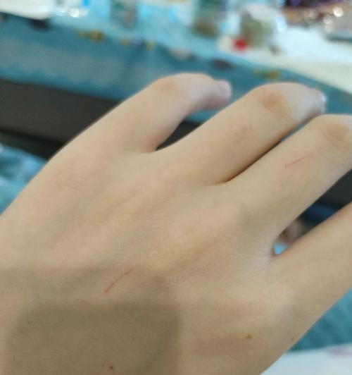 猫抓人怎么喂粮？如何避免猫咪抓人？