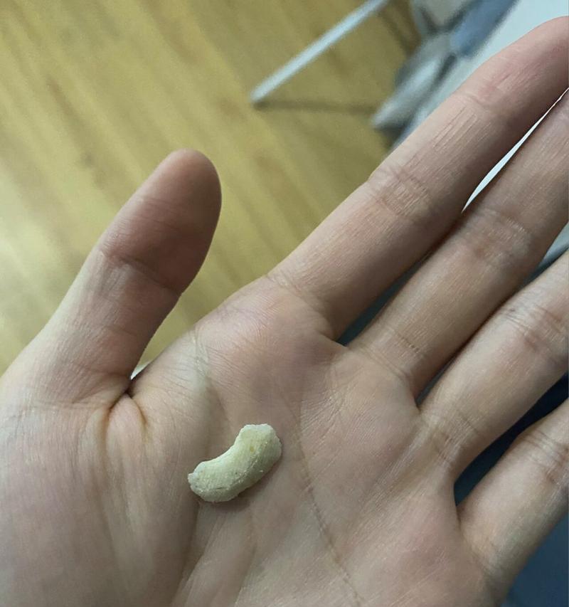 猫尿猫砂粘稠怎么回事？如何解决猫砂结块问题？