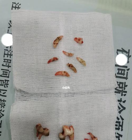 狗狗口腔保健必备（如何正确给狗狗拔牙）