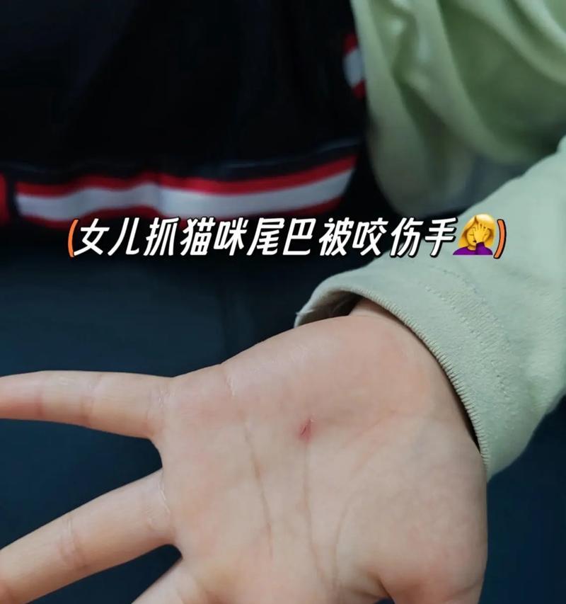 猫咪突然喜欢咬人的原因及解决方法（宠物猫咪的行为变化与调理方法）