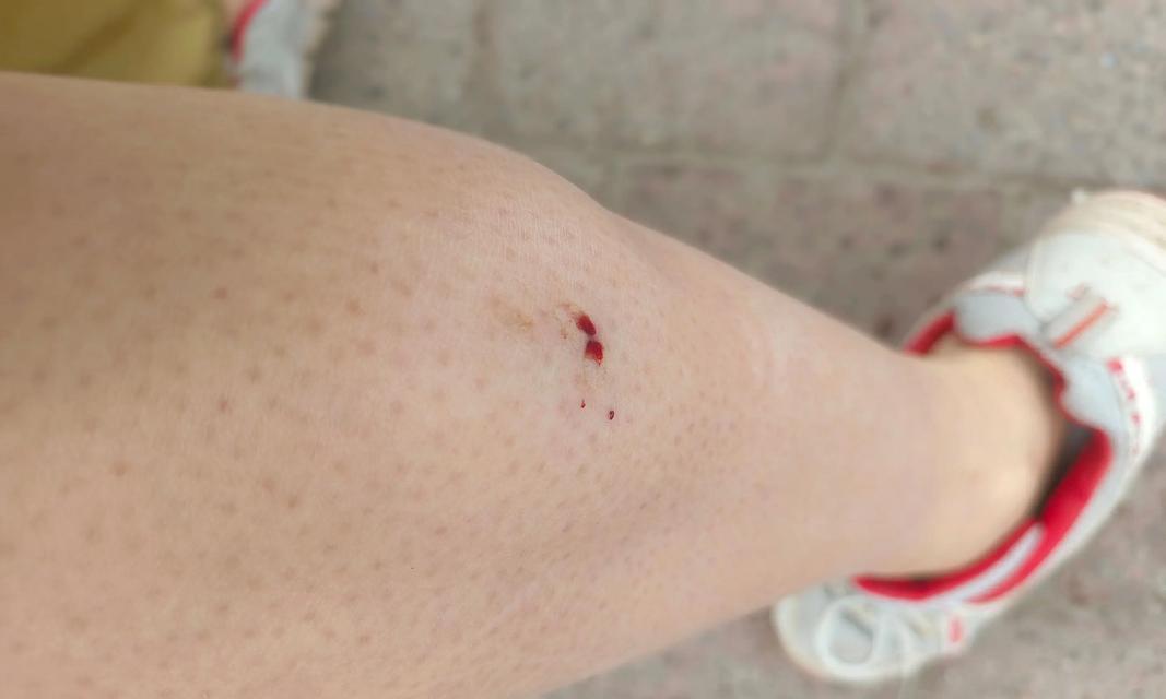 狗狗打过疫苗还会传染病吗（探究狗狗接种疫苗的必要性与有效性）