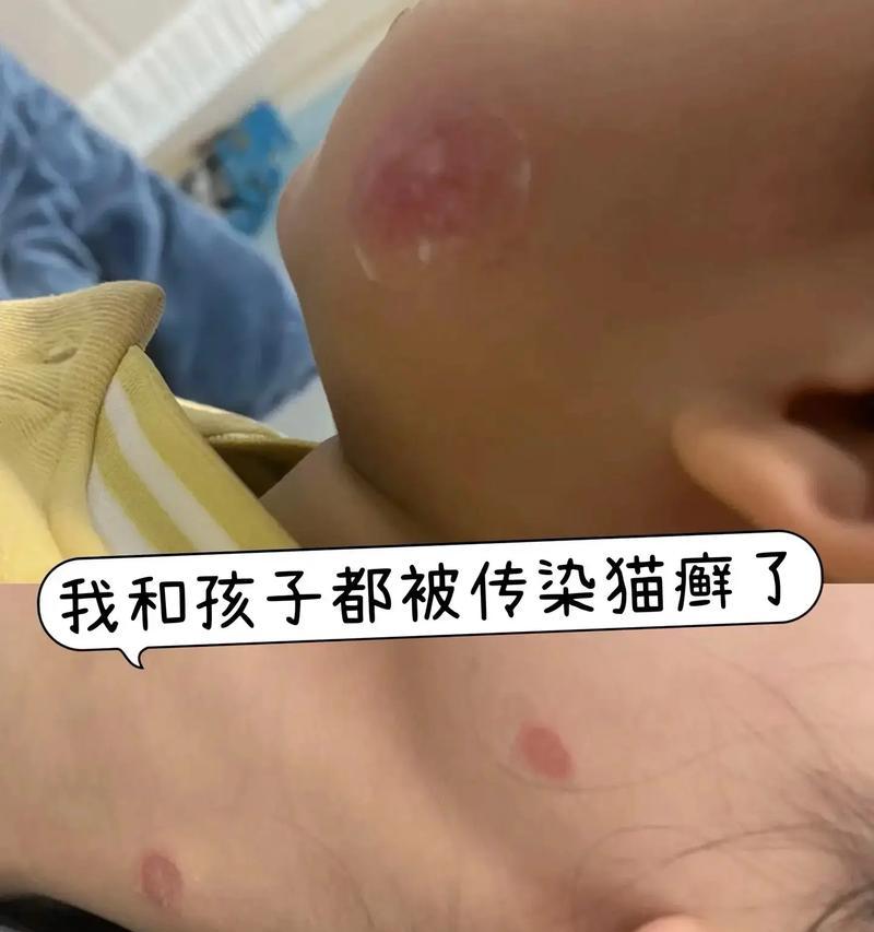探究猫藓症状、治疗与预防