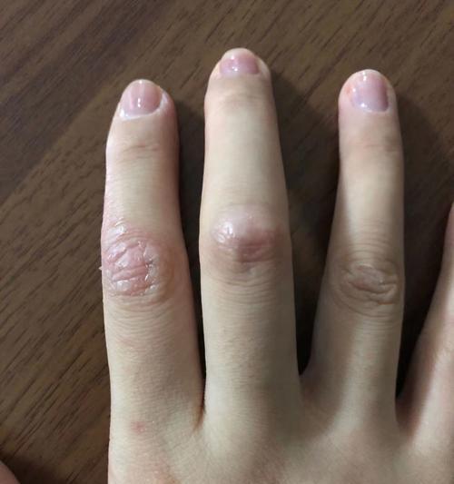 如何预防和治疗小狗皮肤干裂和腕骨垫干裂? 如何预防和治疗小狗皮肤干裂和腕骨垫干裂?