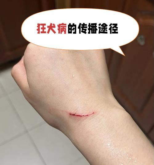 宠物健康与人类健康密不可分的关系(以狗狗布鲁氏杆菌为例探讨狗狗健康问题) 宠物健康与人类健康密不可分的关系(以狗狗布鲁氏杆菌为例探讨狗狗健康问题)