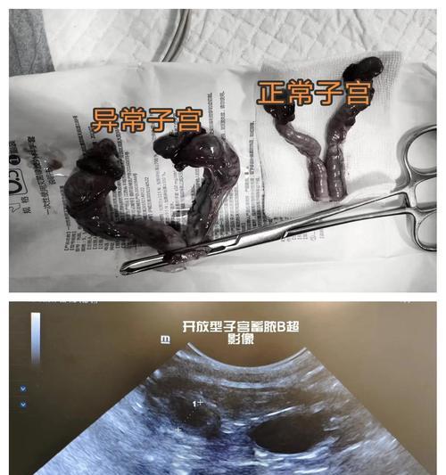 猫咪子宫蓄脓异味原因及治疗方法(揭秘猫咪子宫蓄脓的成因和如何帮助猫咪解决) 猫咪子宫蓄脓异味原因及治疗方法(揭秘猫咪子宫蓄脓的成因和如何帮助猫咪解决)