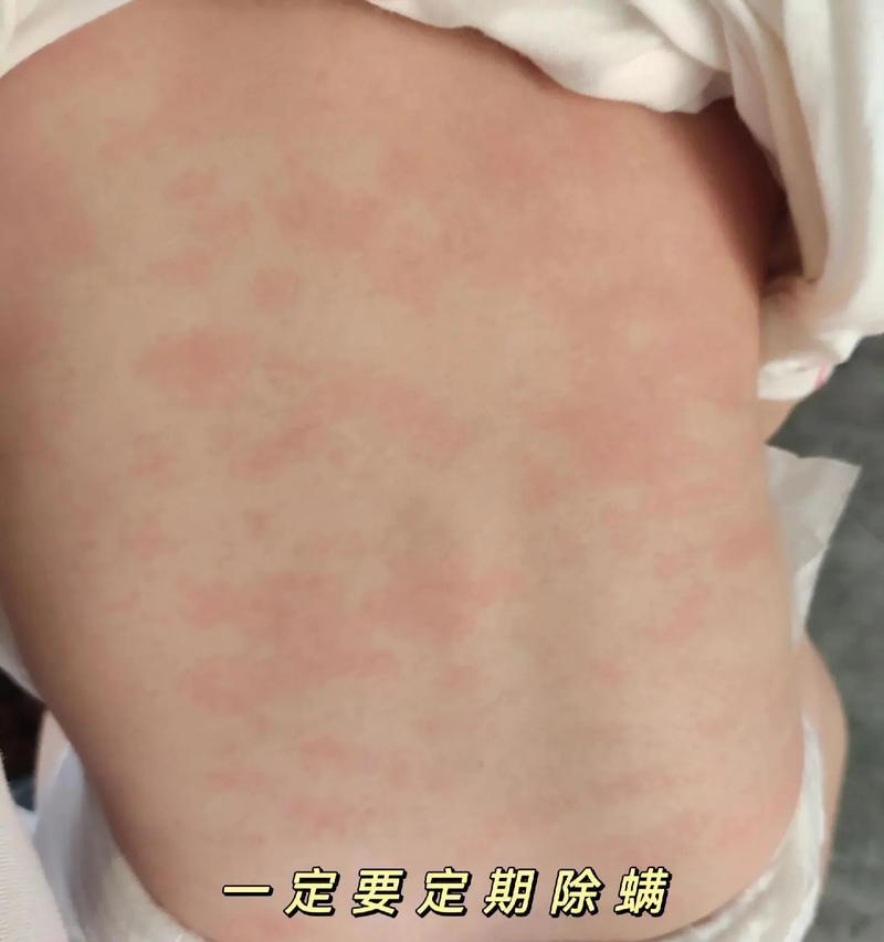小猫皮肤有螨虫症状及预防方法（宠物猫的皮肤问题是如何引起的）