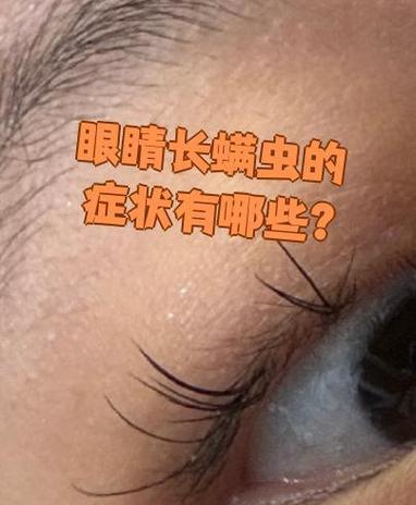 小猫皮肤有螨虫症状及预防方法(宠物猫的皮肤问题是如何引起的) 小猫皮肤有螨虫症状及预防方法(宠物猫的皮肤问题是如何引起的)
