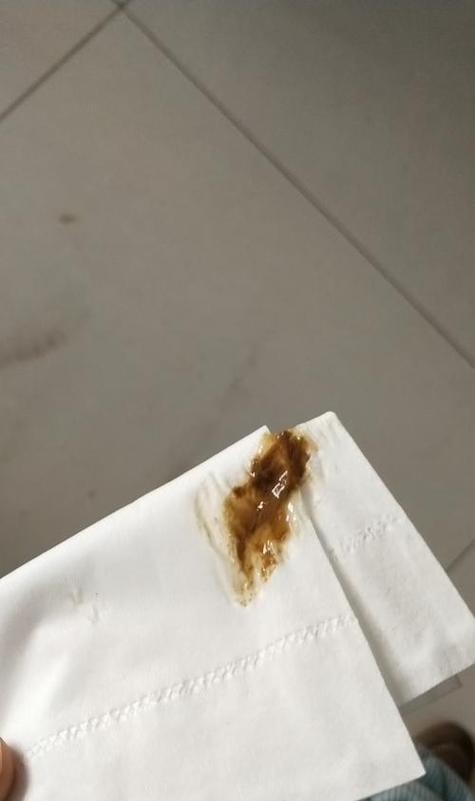 猫咪拉稀的原因和解决方法（探究猫咪拉稀的症状）