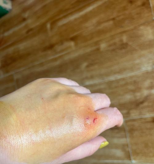 小猫咬出血该怎么办（关爱宠物）