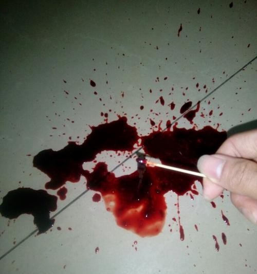 揭秘宠物狗狗拉血的真相，教你如何正确应对（揭秘宠物狗狗拉血的真相）