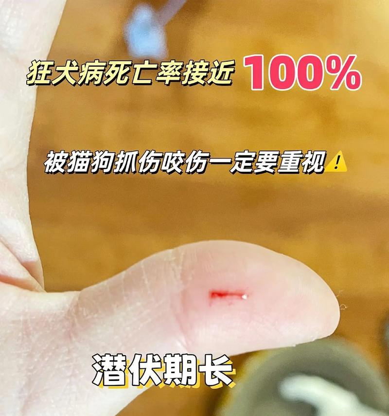 当宠物狗伤人——如何避免和处理宠物狗抓伤事件