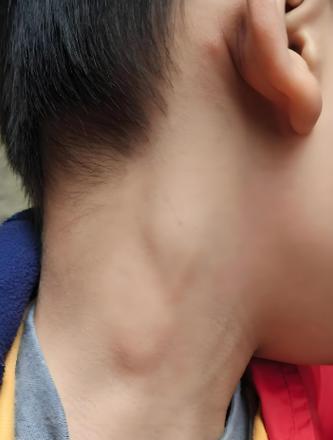 脖子上长了硬疙瘩的萌宠（宠物的健康需要我们关注）