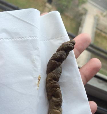 泰迪吃狗粮便便发黑的原因与应对方法（以宠物为主）