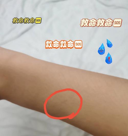 小狗牙齿碰到我了，该怎么办（宠物护理指南）